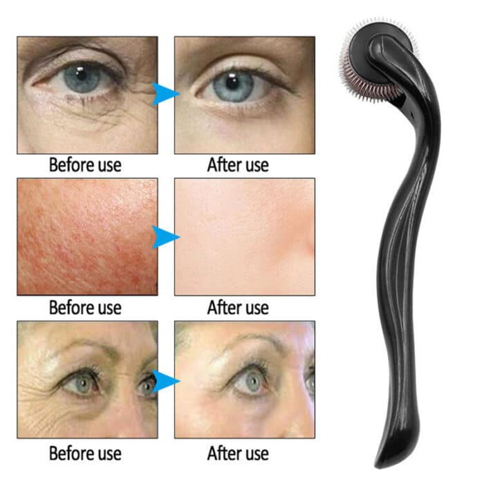 Derma Roller for Hair Growth